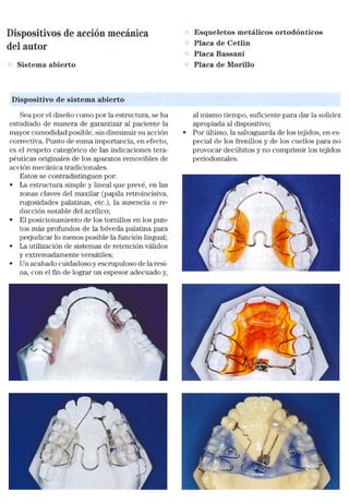 Tecnicas Ortodonticas