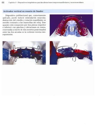 Tecnicas Ortodonticas