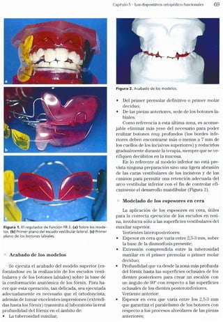 Tecnicas Ortodonticas