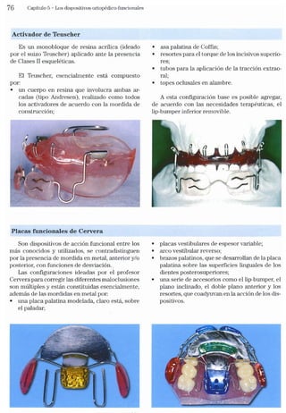 Tecnicas Ortodonticas