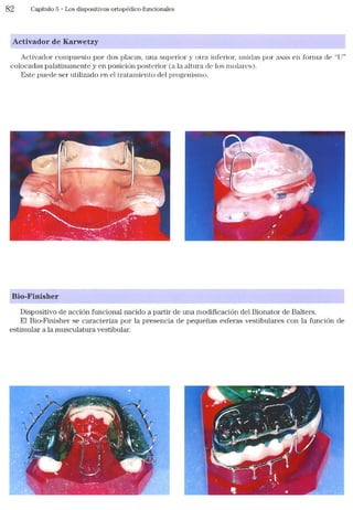 Tecnicas Ortodonticas