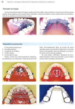 Tecnicas Ortodonticas