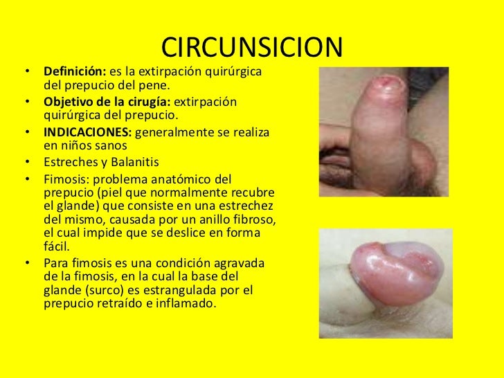 Por qué el miembro pequeño y como aumentar