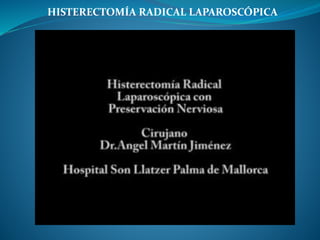 HISTERECTOMÍA RADICAL LAPAROSCÓPICA
