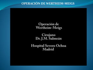 OPERACIÓN DE WERTHEIM-MEIGS