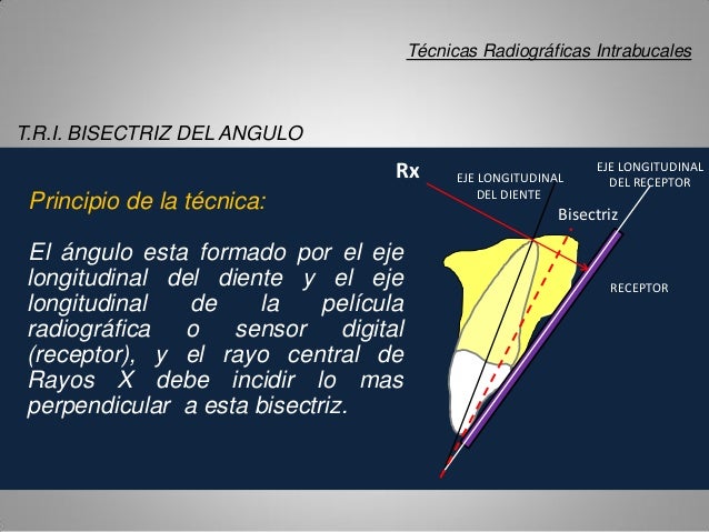 Técnica radiografica intrabucal periapical bisectriz del ángulo.