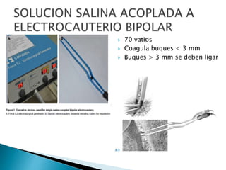  70 vatios
 Coagula buques < 3 mm
 Buques > 3 mm se deben ligar
 