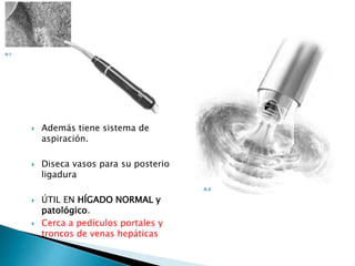  Además tiene sistema de
aspiración.
 Diseca vasos para su posterior
ligadura
 ÚTIL EN HÍGADO NORMAL y
patológico.
 Cerca a pedículos portales y
troncos de venas hepáticas
 