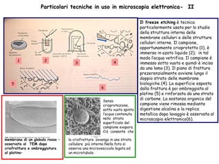 Particolari tecniche in uso in microscopia elettronica-  II Senza crioprotezione, sotto vuoto spinto  l’acqua contenuta nello  strato superficiale del campione evapora. Ciò  consente  che  membrana di un globulo rosso – osservata al  TEM dopo  criofrattura e ombreggiatura al platino– Il freeze etching  è tecnica particolarmente usata per lo studio della struttura interna delle membrane cellulari e delle strutture cellulari interne. Il campione, opportunamente crioprotetto (1), è immerso in azoto liquido (2);  in tal modo l’acqua vetrifica. Il campione è immesso sotto vuoto e quindi è inciso da una lama (3). Il piano di frattura prezerenzialmente avviene lungo il doppio strato delle mambrane biologiche (4). La superficie esposta dalla frattura è poi ombreggiata al platino (5) e rinforzata da una strato di carbone. La sostanza organica del campione viene rimossa mediante digestione alcalina e la replica metallica dopo lavaggio è osservata al microscopio elettronico(6).  la criofrattura  avvenga in uno strato cellulare  più interno Nella foto si osserva una microvescicola legata ad un microtubulo.  1 2 3 4 5 6 