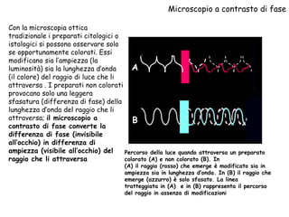 Microscopio a contrasto di fase Con la microscopia ottica tradizionale i preparati citologici o istologici si possono osservare solo se opportunamente colorati. Essi modificano sia l’ampiezza (la luminosità) sia la lunghezza d’onda (il colore) del raggio di luce che li attraversa . I preparati non colorati provocano solo una leggera sfasatura (differenza di fase) della lunghezza d’onda del raggio che li attraversa;  il microscopio a contrasto di fase converte la differenza di fase (invisibile all’occhio) in differenza di ampiezza (visibile all’occhio) del raggio che li attraversa B Percorso della luce quando attraversa un preparato colorato (A) e non colorato (B). In  (A) il raggio (rosso) che emerge è modificato sia in ampiezza sia in lunghezza d’onda. In (B) il raggio che emerge (azzurro) è solo sfasato. La linea tratteggiata in (A)  e in (B) rappresenta il percorso del raggio in assenza di modificazioni A 