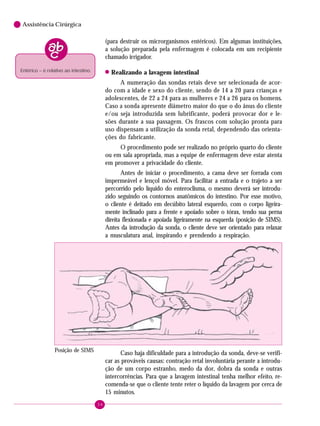 34
6 Assistência Cirúrgica
(para destruir os microrganismos entéricos). Em algumas instituições,
a solução preparada pela enfermagem é colocada em um recipiente
chamado irrigador.
! Realizando a lavagem intestinal
A numeração das sondas retais deve ser selecionada de acor-
do com a idade e sexo do cliente, sendo de 14 a 20 para crianças e
adolescentes, de 22 a 24 para as mulheres e 24 a 26 para os homens.
Caso a sonda apresente diâmetro maior do que o do ânus do cliente
e/ou seja introduzida sem lubrificante, poderá provocar dor e le-
sões durante a sua passagem. Os frascos com solução pronta para
uso dispensam a utilização da sonda retal, dependendo das orienta-
ções do fabricante.
O procedimento pode ser realizado no próprio quarto do cliente
ou em sala apropriada, mas a equipe de enfermagem deve estar atenta
em promover a privacidade do cliente.
Antes de iniciar o procedimento, a cama deve ser forrada com
impermeável e lençol móvel. Para facilitar a entrada e o trajeto a ser
percorrido pelo líquido do enteroclisma, o mesmo deverá ser introdu-
zido seguindo os contornos anatômicos do intestino. Por esse motivo,
o cliente é deitado em decúbito lateral esquerdo, com o corpo ligeira-
mente inclinado para a frente e apoiado sobre o tórax, tendo sua perna
direita flexionada e apoiada ligeiramente na esquerda (posição de SIMS).
Antes da introdução da sonda, o cliente deve ser orientado para relaxar
a musculatura anal, inspirando e prendendo a respiração.
Entérico – é relativo ao intestino.
Caso haja dificuldade para a introdução da sonda, deve-se verifi-
car as prováveis causas: contração retal involuntária perante a introdu-
ção de um corpo estranho, medo da dor, dobra da sonda e outras
intercorrências. Para que a lavagem intestinal tenha melhor efeito, re-
comenda-se que o cliente tente reter o líquido da lavagem por cerca de
15 minutos.
Posição de SIMS
 