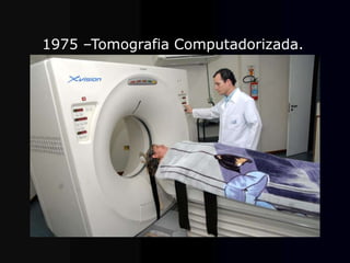 1975 –Tomografia Computadorizada.
 
