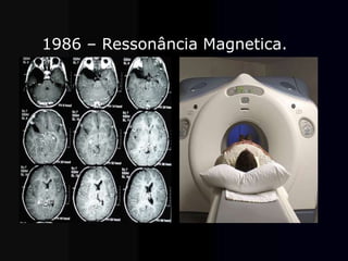 1986 – Ressonância Magnetica.
 