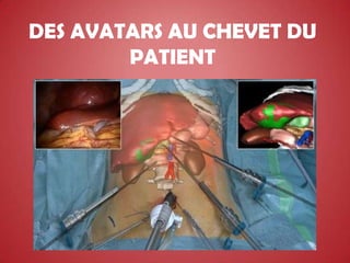 DES AVATARS AU CHEVET DU
        PATIENT
 