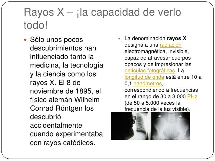 Rayos X – ¡la capacidad de verlo todo!<br />Sólo unos pocos descubrimientos han influenciado tanto la medicina, la tecnolo...
