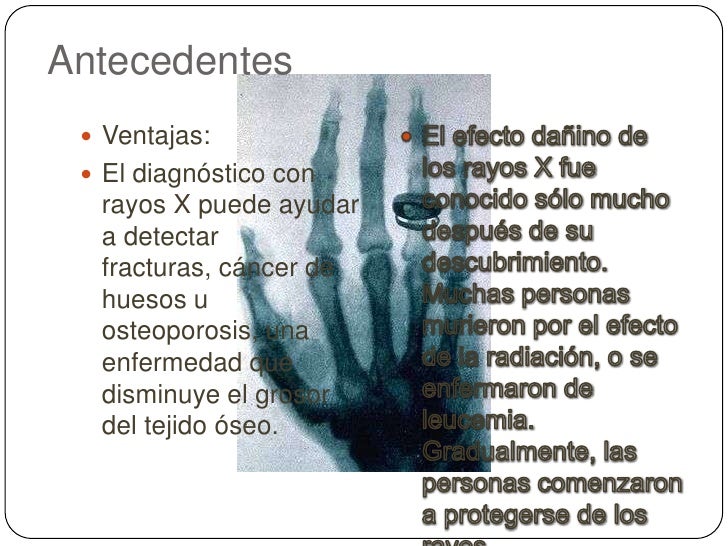 Antecedentes <br />Ventajas:<br />El diagnóstico con rayos X puede ayudar a detectar fracturas, cáncer de huesos u osteopo...