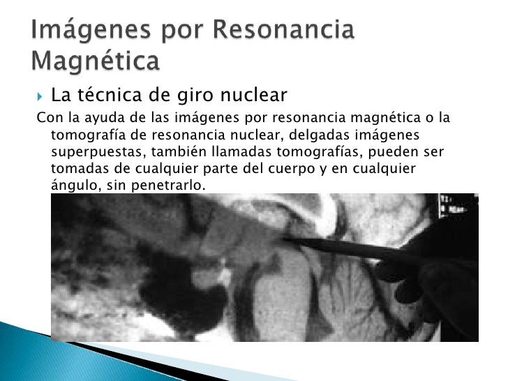 La técnica de giro nuclear<br />Con la ayuda de las imágenes por resonancia magnética o la tomografía de resonancia nuclea...