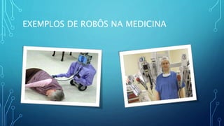 EXEMPLOS DE ROBÔS NA MEDICINA
 
