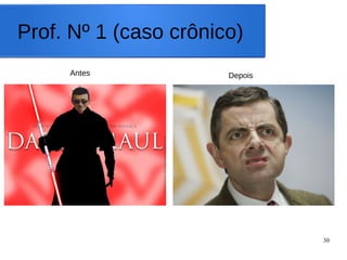 30
Prof. Nº 1 (caso crônico)
Antes Depois
 