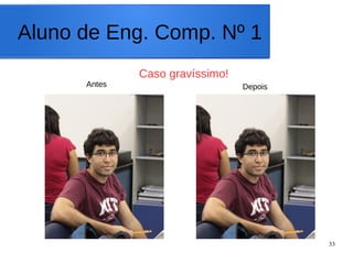 33
Aluno de Eng. Comp. Nº 1
Caso gravíssimo!
Antes Depois
 