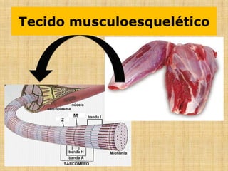 Tecido musculoesquelético
 