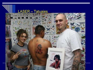 Láser – TratamientoLéntigoLaser Nd-Yag  Medlite C6