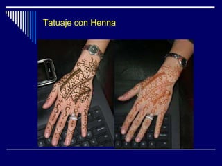 Láser – TratamientoTatuajesLáser neodimio-yag.- En la modalidad Q-Switched532 nm elimina el color rojo y el naranja;   1064 nm elimina todos los colores, excepto el verde, rojo y naranja. Láser de colorante pulsado.- Color negro y colores rojo y verde. Láser de alejandrita.- Tatuaje blanco, azul y verde. Láser de rubí.- En la modalidad Q-Switched (pulsos de 25-40 ms de duración) especialmente negros, verdes y otros colores oscuros, es ineficazcon el rojo y colores claros. Se utiliza también en lesiones pigmentadas. 