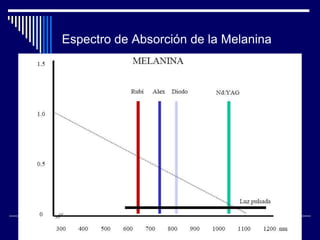 Láser – TratamientoTatuajes Laser Nd-Yag  Medlite C6