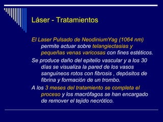 LASER – Tatuajes 
