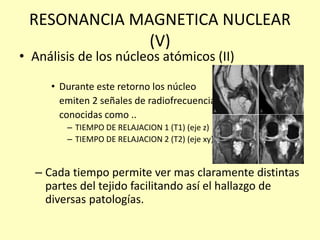 RESONANCIA MAGNETICA NUCLEAR
(V)
• Análisis de los núcleos atómicos (II)
• Durante este retorno los núcleo
emiten 2 señales de radiofrecuencia
conocidas como ..
– TIEMPO DE RELAJACION 1 (T1) (eje z)
– TIEMPO DE RELAJACION 2 (T2) (eje xy)
– Cada tiempo permite ver mas claramente distintas
partes del tejido facilitando así el hallazgo de
diversas patologías.
 