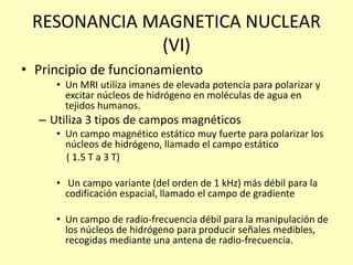 RESONANCIA MAGNETICA NUCLEAR
(VI)
• Principio de funcionamiento
• Un MRI utiliza imanes de elevada potencia para polarizar y
excitar núcleos de hidrógeno en moléculas de agua en
tejidos humanos.
– Utiliza 3 tipos de campos magnéticos
• Un campo magnético estático muy fuerte para polarizar los
núcleos de hidrógeno, llamado el campo estático
( 1.5 T a 3 T)
• Un campo variante (del orden de 1 kHz) más débil para la
codificación espacial, llamado el campo de gradiente
• Un campo de radio-frecuencia débil para la manipulación de
los núcleos de hidrógeno para producir señales medibles,
recogidas mediante una antena de radio-frecuencia.
 