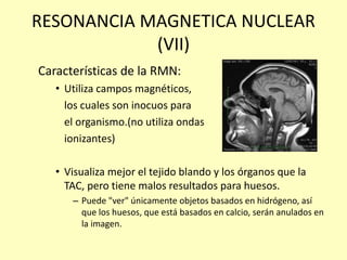 RESONANCIA MAGNETICA NUCLEAR
(VII)
Características de la RMN:
• Utiliza campos magnéticos,
los cuales son inocuos para
el organismo.(no utiliza ondas
ionizantes)
• Visualiza mejor el tejido blando y los órganos que la
TAC, pero tiene malos resultados para huesos.
– Puede "ver" únicamente objetos basados en hidrógeno, así
que los huesos, que está basados en calcio, serán anulados en
la imagen.
 