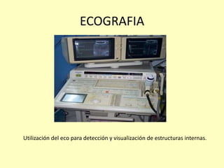 ECOGRAFIA
Utilización del eco para detección y visualización de estructuras internas.
 