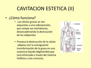 CAVITACION ESTETICA (II)
• ¿Cómo funciona?
• Las células grasas se ven
expuestas a una sobrepresión,
que rompe sus membranas,
desencadenando la destrucción
de los adipocitos
• Provoca la destrucción de la célula
adiposa con la consiguiente
transformación de la grasa en una
sustancia líquida (diglicérido) que
será eliminada a través del sistema
linfático y vías urinarias.
 