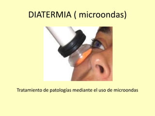 DIATERMIA ( microondas)
Tratamiento de patologías mediante el uso de microondas
 