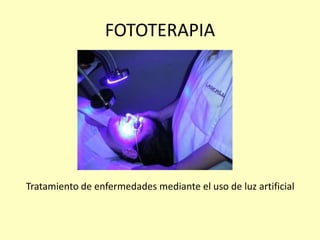 FOTOTERAPIA
Tratamiento de enfermedades mediante el uso de luz artificial
 