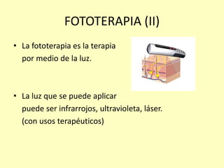 FOTOTERAPIA (II)
• La fototerapia es la terapia
por medio de la luz.
• La luz que se puede aplicar
puede ser infrarrojos, ultravioleta, láser.
(con usos terapéuticos)
 