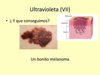 Ultravioleta (VII)
• ¿ Y que conseguimos?
Un bonito melanoma
 
