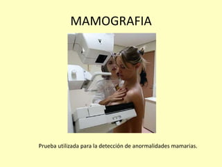 MAMOGRAFIA
Prueba utilizada para la detección de anormalidades mamarias.
 