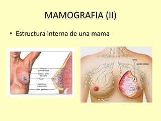 MAMOGRAFIA (II)
• Estructura interna de una mama
 