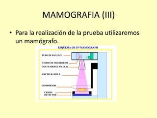 MAMOGRAFIA (III)
• Para la realización de la prueba utilizaremos
un mamógrafo.
 