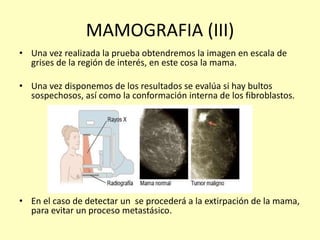 MAMOGRAFIA (III)
• Una vez realizada la prueba obtendremos la imagen en escala de
grises de la región de interés, en este cosa la mama.
• Una vez disponemos de los resultados se evalúa si hay bultos
sospechosos, así como la conformación interna de los fibroblastos.
• En el caso de detectar un se procederá a la extirpación de la mama,
para evitar un proceso metastásico.
 