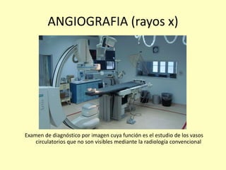 ANGIOGRAFIA (rayos x)
Examen de diagnóstico por imagen cuya función es el estudio de los vasos
circulatorios que no son visibles mediante la radiología convencional
 