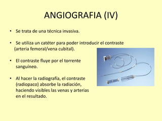 ANGIOGRAFIA (IV)
• Se trata de una técnica invasiva.
• Se utiliza un catéter para poder introducir el contraste
(arteria femoral/vena cubital).
• El contraste fluye por el torrente
sanguíneo.
• Al hacer la radiografía, el contraste
(radiopaco) absorbe la radiación,
haciendo visibles las venas y arterias
en el resultado.
 