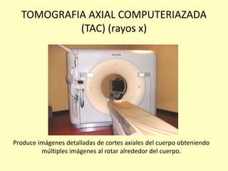 TOMOGRAFIA AXIAL COMPUTERIAZADA
(TAC) (rayos x)
Produce imágenes detalladas de cortes axiales del cuerpo obteniendo
múltiples imágenes al rotar alrededor del cuerpo.
 