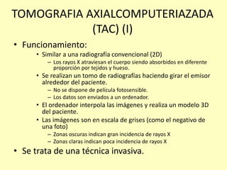 TOMOGRAFIA AXIALCOMPUTERIAZADA
(TAC) (I)
• Funcionamiento:
• Similar a una radiografía convencional (2D)
– Los rayos X atraviesan el cuerpo siendo absorbidos en diferente
proporción por tejidos y hueso.
• Se realizan un tomo de radiografías haciendo girar el emisor
alrededor del paciente.
– No se dispone de película fotosensible.
– Los datos son enviados a un ordenador.
• El ordenador interpola las imágenes y realiza un modelo 3D
del paciente.
• Las imágenes son en escala de grises (como el negativo de
una foto)
– Zonas oscuras indican gran incidencia de rayos X
– Zonas claras indican poca incidencia de rayos X
• Se trata de una técnica invasiva.
 