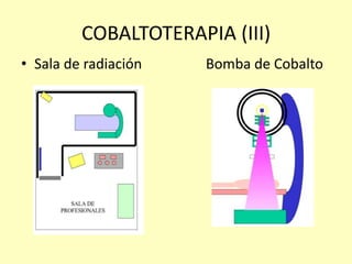 COBALTOTERAPIA (III)
• Sala de radiación Bomba de Cobalto
 