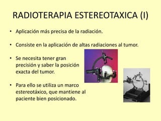 RADIOTERAPIA ESTEREOTAXICA (I)
• Aplicación más precisa de la radiación.
• Consiste en la aplicación de altas radiaciones al tumor.
• Se necesita tener gran
precisión y saber la posición
exacta del tumor.
• Para ello se utiliza un marco
estereotáxico, que mantiene al
paciente bien posicionado.
 