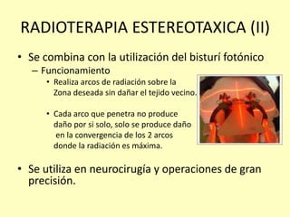 RADIOTERAPIA ESTEREOTAXICA (II)
• Se combina con la utilización del bisturí fotónico
– Funcionamiento
• Realiza arcos de radiación sobre la
Zona deseada sin dañar el tejido vecino.
• Cada arco que penetra no produce
daño por si solo, solo se produce daño
en la convergencia de los 2 arcos
donde la radiación es máxima.
• Se utiliza en neurocirugía y operaciones de gran
precisión.
 