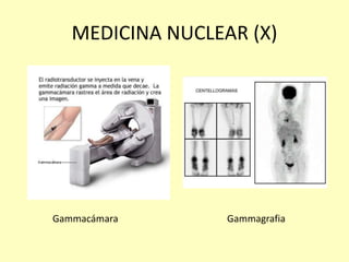 MEDICINA NUCLEAR (X)
Gammacámara Gammagrafia
 